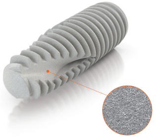 etatdesurface